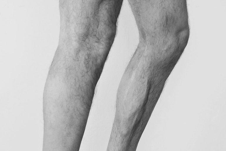 Warum rasieren sich Radfahrer die Beine?